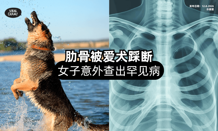 【因祸得福❗】肋骨被爱犬踩断⚡ 女子检查竟「发现罕见病」及时治疗!