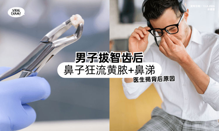【拔智齿后惨了❗】男子鼻子狂流「黄脓+鼻涕⚡」医生揭开背后原因!
